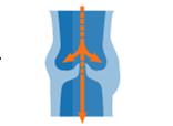 Sistema circulatorio y varices | Recurso educativo 45766