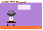 Game: The split brain experiments | Recurso educativo 49435