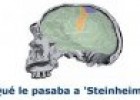 Qué le pasaba a "Steinheim" | Recurso educativo 55261