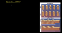 Seismic waves | Recurso educativo 72380